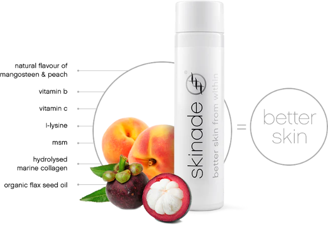 skinade_ireland